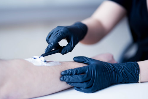 NITRAS BLACK SCORPION Latex-Einmalhandschuhe Gr. M